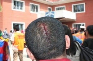 A Tibetan protester with a head wound